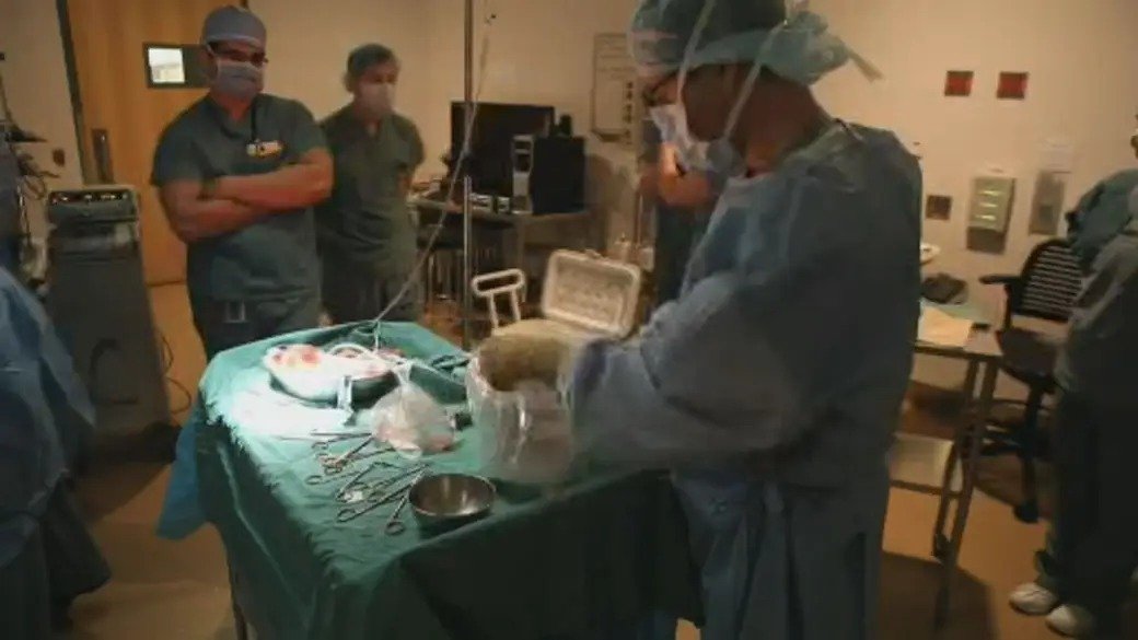 Seniors Struggle to Recover from Surgery: Study Reveals High Rates of Post-Op Disability