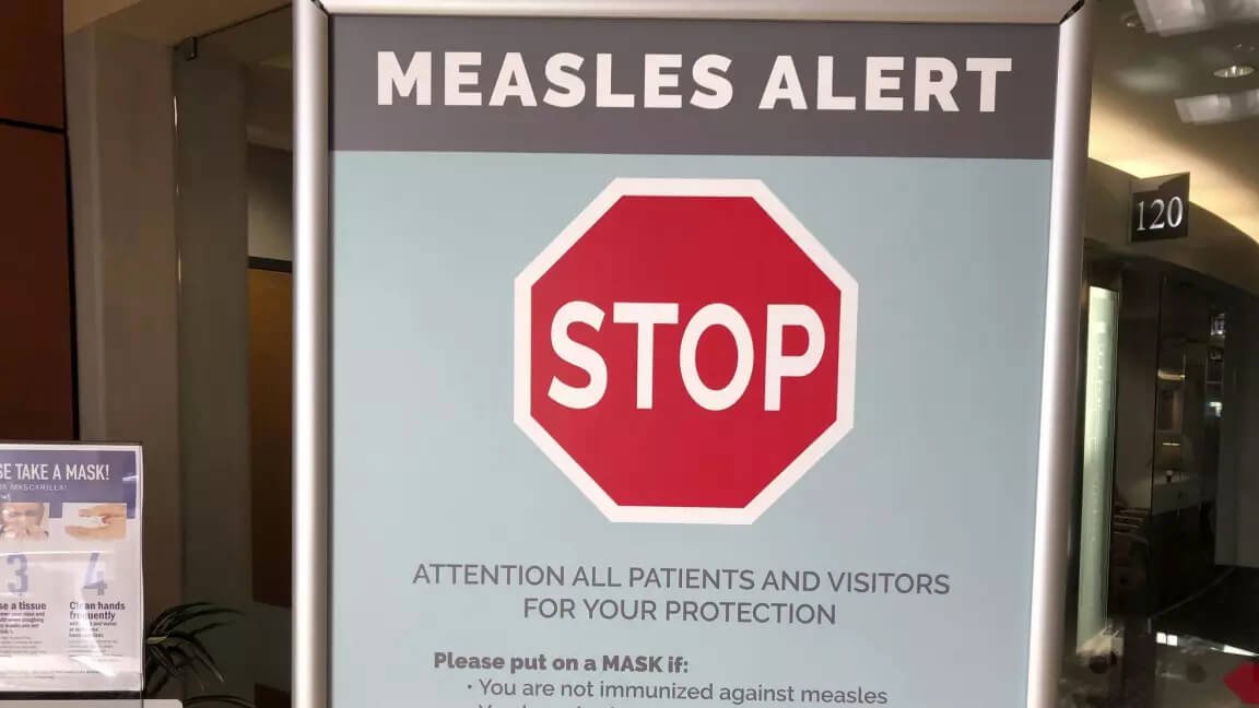 Manitoba Issues Measles Alert After Potential Exposures at Brandon Ag Days and Winkler